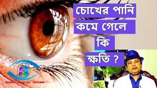 চোখের পানি কমে যাওয়ার লক্ষণ ? | lacrimal gland swelling |  Anam Doctor House