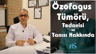 Özofagus Tümörü, Tedavisi ve Tanısı Hakkında Op. Dr. Aytaç Sayın