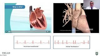 “Give Me My Sinus Rhythm Back! The latest Update on Atrial Fibrillation Management”