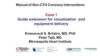 Case 1: PCI Manual - Guide extension for visualization and equipment delivery