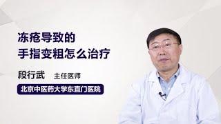 冻疮导致的手指变粗怎么治疗 段行武 北京中医药大学东直门医院