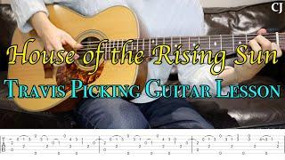 House of the Rising Sun - Tommy Emmanuel (With Tab) | Watch & Learn Travis Picking Guitar Lesson