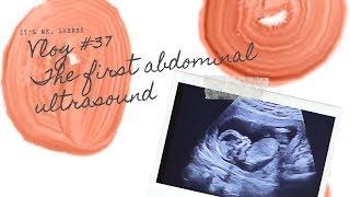 Pregnancy in Japan | What it’s like to get an Ultrasound