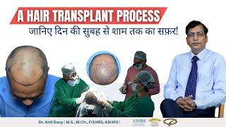 Hair Transplant कैसे करते हैं? | Full-Day Journey of a Hair Transplant Procedure | By Dr Anil Garg