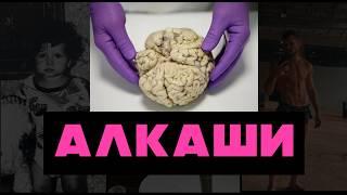 Алкаши - страшные последствия отказа от алкоголя | Алкоголизм  и психические изменения личности