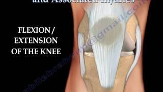 Knee  injury ,Injuries - Everything You Need To Know - Dr. Nabil Ebraheim