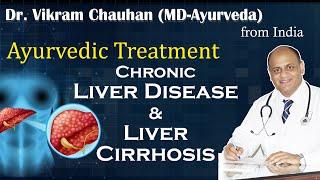 Dr. Vikram Chauhan-Ayurveda MD from India Ayurvedic treatment chronic Liver Disease/Cirrhosis