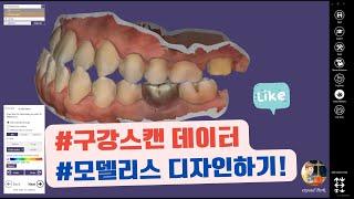 (2) CAD_exocad #구강스캔 데이터 #모델리스 디자인하기! (How to design intraoral scan data using exocad)