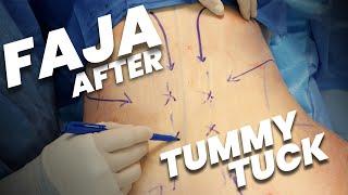 Post-Tummy Tuck Secrets: Compression after Surgery