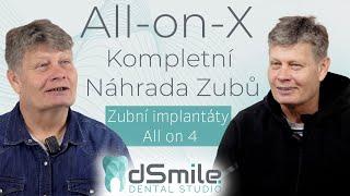 Vše o Zubní Implantaci: All-on-X - Kompletní Náhrada Zubů