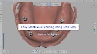 Easy Edentulous Scanning Using Scan Body (Replicate Existing Data)