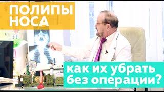 Лечение полипов в носу без операции - как исчезают полипы с помощью методики доктора Пурясева С.М.