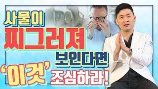 사물이 찌그러져 보이는 '망막전막'의 모든 것! - 아이조아 #19