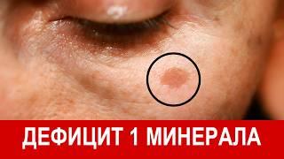 В ЭТОМ КРОЕТСЯ ПРИЧИНА ПИГМЕНТНЫХ ПЯТЕН НА РУКАХ!