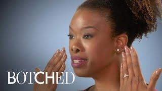 Kelli's Desire for a Smaller Nose Ends in Disaster | Botched | E!