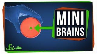 What Growing Mini Brains Has Taught Us, And What's Next