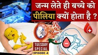 नवजात शिशु में पीलिया क्यों होता है ? क्या करे | How to handle Jaundice in Newborn? In Hindi