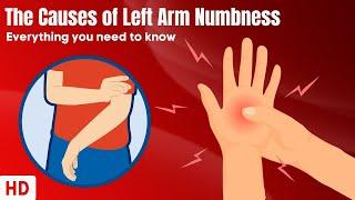 The Causes Of Left Arm Numbness