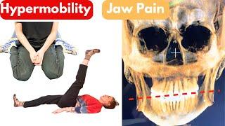 Jaw Pain and Hypermobility (Is it ALL connected?)
