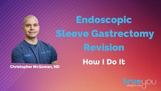 Endoscopic Revision of Sleeve Gastrectomy: How I Do It