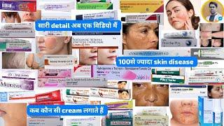 कब कौन सी cream/ointment का यूज करते हैं/skin की कौन सी बिमारी मैं कौन सी cream/ointment लगाते हैं