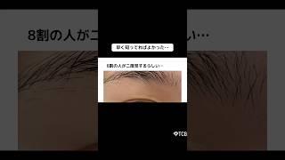 【二重整形】8割の人が二度見するらしい… #shorts
