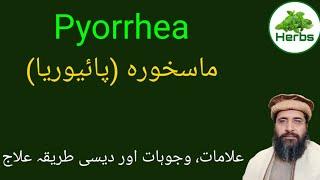 Pyorrhea | مسوڑھوں کی بیماری | ماسخورہ کا علاج | Hakeem Zia ur Rehman