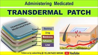 Transdermal Medicated patch | Transdermal patch | Transdermal Drug Delivery TDD | Made Easy