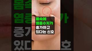 몸속에서 염증 수치가 증가하고 있다는 신호 6가지 - ‍️이곳저곳이 아프면~ 꼭 체크!