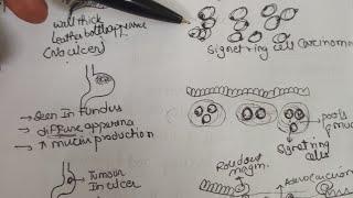 GASTRIC CARCINOMA-PATHOLOGY