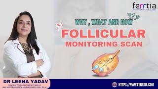 Why, What and How Follicular Monitoring Scan