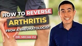 How to REVERSE Arthritis NATURALLY from a Rheumatologist!