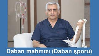 Daban mahmızının müalicəsi ( Daban şporu)