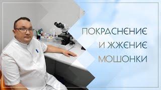 ↪ Покраснение и жжение мошонки. Клинический случай №77