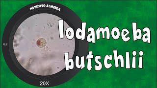 Iodamoeba butschlii