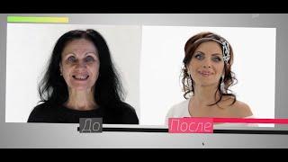 На 10 лет моложе - Как происходит процесс установки виниров