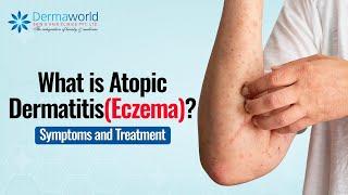 What is Atopic Dermatitis(Eczema)? | Symptoms and Treatment | #DermaworldDelhi #DrRohitBatra