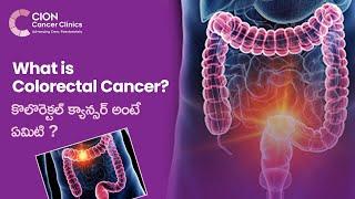 What is Colorectal Cancer? | Risk Factors | Diagnosis | Prevention | Dr. Gundu Naresh | CION