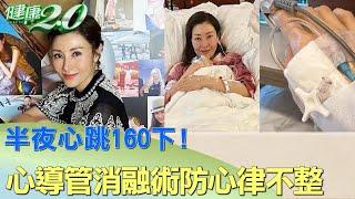 半夜心跳160下! 李嘉欣心導管消融術防心律不整 健康2.0