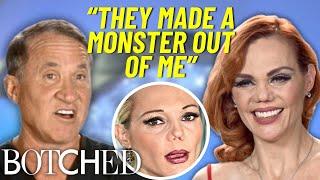 REJECTED By Botched: Carmen's Top Model Nose Destroyed In Freak Accident | Botched | E!