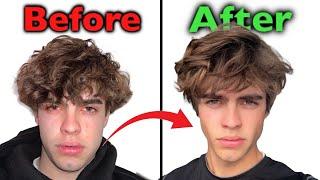 6 ways to lose face fat (Full Guide)