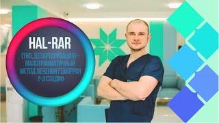 HAL-RAR (THD, дезартеризация) - малотравматичный метод лечения геморроя 2-3 стадии