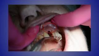 Case of the Week: Immediate Extraction and Implant Placement