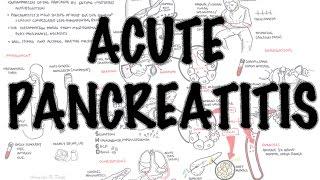 Acute Pancreatitis - Overview (signs and symptoms, pathophysiology, investigations, treatment)