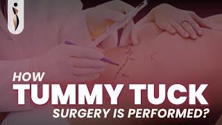 How is tummy tuck surgery performed? Dr. Amiti Shah- Board Certified Cosmetic & Plastic Surgeon