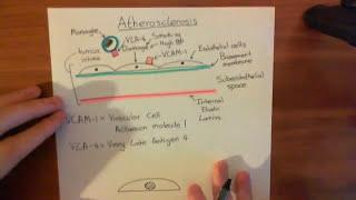 Atherosclerosis Pathogenesis Part 1