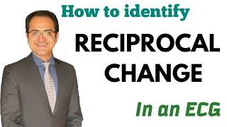 Reciprocal Changes in an ECG (12 Lead) Explained, ECG Lectures USMLE/NEET PG