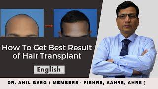 Hair Transplant Indore | Best Hair Transplant Doctor In Indore | Cost of Hair Transplant Clinic