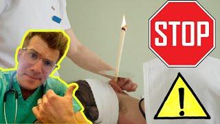 Is ear candling safe to remove ear wax? Doctor explains... #shorts
