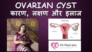 OVARIAN CYST ओवरी में गाँठ / सिस्ट (HINDI) Gynaecologist Dr Dipti Jain Ahmedabad